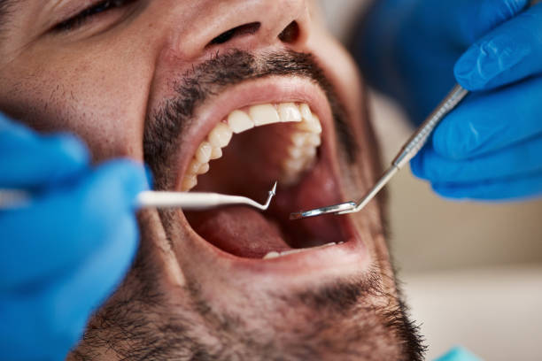 Best Mobile Emergency Dentist in Germantown, MD