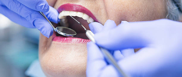 Best Emergency Dentist for Lost Fillings or Crowns in Germantown, MD